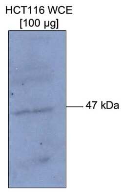 Western Blot: p53 [Methyl Lys372] Antibody [NBP2-59153] - Western blot was performed on 100 ug Colon carcinoma whole cell extract (HCT116 WCE) using the antibody against p53K372me1, diluted 1:200 in TBS-Tween containing 5% skimmed milk. The size and location of the protein of interest are indicated.